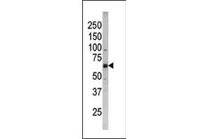 The anti-Phospho-CDC25B- Pab (ABIN389534 and ABIN2839581) is used in Western blot to detect Phospho-CDC25B- in SK-BR-3 tissue lysate (CDC25B antibody  (pSer187))