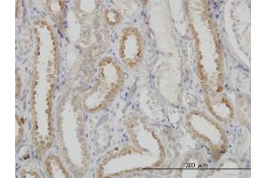 Immunoperoxidase of monoclonal antibody to NDUFS3 on formalin-fixed paraffin-embedded human kidney.