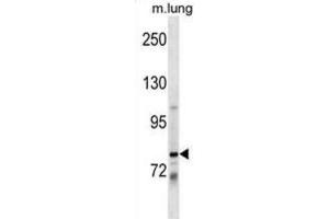 Western Blotting (WB) image for anti-Dachshund 1 (DACH1) antibody (ABIN2999622) (DACH1 antibody)