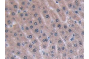 Detection of IL6 in Rat Liver Tissue using Monoclonal Antibody to Interleukin 6 (IL6) (IL-6 antibody  (AA 21-211))