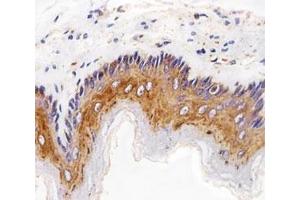 Immunohistochemical analysis of paraffin-embedded rat esophagus using EGF Receptor antibody at 1:25 dilution. (EGFR antibody  (AA 1163-1191))