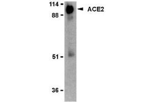 Western blot analysis of ACE2 in human kidney lysate with AP30009PU-N ACE2 antibody (IN2) at 2 μg/ml. (ACE2 antibody  (Intermediate Domain 2))