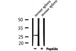 Western blot analysis of extracts from mouse spleen, using ARHGDIA Antibody.