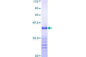 Keratin 10 Protein (KRT10) (AA 345-454) (GST tag)