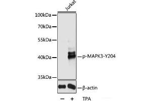 Western blot analysis of extracts of Jurkat cells using Phospho-MAPK3(Y204) Polyclonal Antibody at dilution of 1:2000. (ERK1 antibody  (pTyr204))