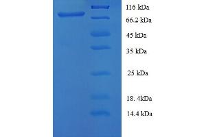 SDS-PAGE (SDS) image for Melanoma Cell Adhesion Molecule (MCAM) (AA 50-646), (partial) protein (His tag) (ABIN5712730) (MCAM Protein (AA 50-646, partial) (His tag))