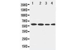 Anti-LCAT antibody, Western blotting Lane 1: Rat Brain Tissue Lysate Lane 2: U87 Cell Lysate Lane 3: HELA Cell Lysate Lane 4: SMMC Cell Lysate (LCAT antibody  (C-Term))