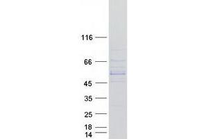 Validation with Western Blot (CYP11B1 Protein (Transcript Variant 2) (Myc-DYKDDDDK Tag))