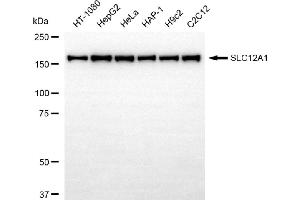 anti-Solute Carrier Family 12 (Sodium/potassium/chloride Transporters), Member 1 (SLC12A1) antibody