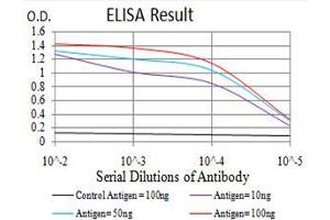 Black line: Control Antigen (100 ng), Purple line: Antigen(10 ng), Blue line: Antigen (50 ng), Red line: Antigen (100 ng), (CBX2 antibody  (AA 402-525))
