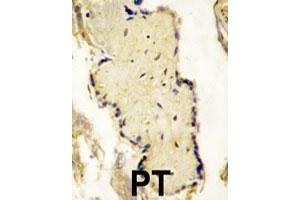 Formalin-fixed and paraffin-embedded placenta tissue reacted with SPPL2A polyclonal antibody  , which was peroxidase-conjugated to the secondary antibody, followed by DAB staining. (SPPL2A antibody  (N-Term))