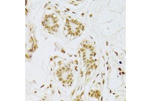 Immunohistochemistry (Paraffin-embedded Sections) (IHC (p)) image for anti-Small Nuclear Ribonucleoprotein Polypeptide A (SNRPA) (AA 1-282) antibody (ABIN6148210)