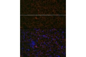 Immunofluorescence analysis of mouse brown adipose using Perilipin A Rabbit mAb (ABIN7269218) at dilution of 1:100 (40x lens). (PLIN1 antibody)