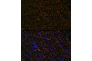 Immunofluorescence analysis of mouse brown adipose using Perilipin A Rabbit mAb (ABIN7269218) at dilution of 1:100 (40x lens). (PLIN1 antibody)