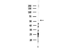 anti-Casein Kinase 1, gamma 3 (CSNK1G3) (N-Term) antibody