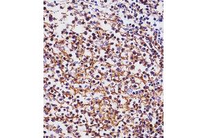 (ABIN1536600 and ABIN2843823) staining MS4A1/CD20 in human tonsil tissue sections by Immunohistochemistry (IHC-P - paraformaldehyde-fixed, paraffin-embedded sections). (CD20 antibody  (C-Term))