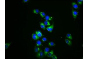 Immunofluorescence staining of Hela cells with ABIN7150934 at 1:133, counter-stained with DAPI. (DRP2 antibody  (AA 697-833))