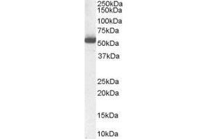ABIN2561029 (1µg/ml) staining of Human Liver Lysate (35µg protein in RIPA buffer). (ALDH1A1 antibody  (Internal Region))