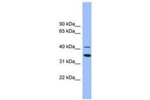 Image no. 1 for anti-GATA Binding Protein 5 (GATA5) (AA 323-372) antibody (ABIN6742225) (GATA5 antibody  (AA 323-372))
