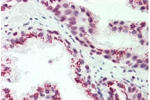 Human Prostate: Formalin-Fixed, Paraffin-Embedded (FFPE) (CASC4 antibody  (AA 336-365))