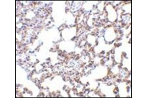Immunohistochemistry of SnoN in mouse lung tissue with this product at 5 μg/ml. (SKIL antibody  (N-Term))