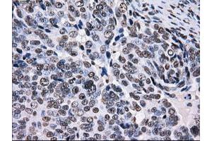 Image no. 15 for anti-Replication Protein A2, 32kDa (RPA2) antibody (ABIN1500736)