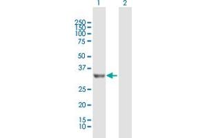 Western Blot analysis of PROSC expression in transfected 293T cell line by PROSC MaxPab polyclonal antibody. (PROSC antibody  (AA 1-275))