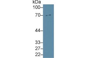 Western Blot; Sample: Rat Liver lysate; Primary Ab: 2µg/ml Rabbit Anti-Rat MMP8 Antibody Second Ab: 0. (MMP8 antibody  (AA 212-451))