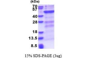 SDS-PAGE (SDS) image for DNA (Cytosine-5-)-Methyltransferase 3 Like (TRDMT1) (AA 1-387) protein (His tag) (ABIN6387414) (DNMT3L Protein (AA 1-387) (His tag))