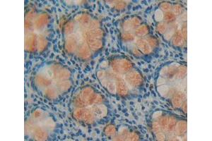 Used in DAB staining on fromalin fixed paraffin- embedded rectum tissue (DPP3 antibody  (AA 2-261))
