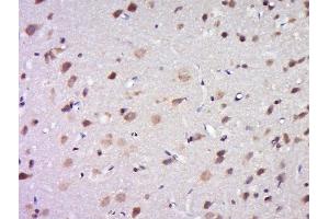 Paraformaldehyde-fixed, paraffin embedded rat brain tissue, Antigen retrieval by boiling in sodium citrate buffer(pH6) for 15min, Block endogenous peroxidase by 3% hydrogen peroxide for 30 minutes, Blocking buffer (normal goat serum) at 37°C for 20min, Antibody incubation with Rabbit Anti-DPAGT1 Polyclonal Antibody, Unconjugated  at 1:500 overnight at 4°C, followed by a conjugated secondary and DAB staining (DPAGT1 antibody  (AA 301-408))