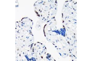 Immunohistochemistry (IHC) image for anti-TAR (HIV-1) RNA Binding Protein 2 (TARBP2) antibody (ABIN7270729)
