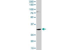 HOXD1 MaxPab rabbit polyclonal antibody. (HOXD1 antibody  (AA 1-328))