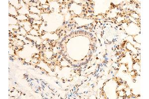 Immunohistochemistry (IHC) image for anti-Eukaryotic Translation Initiation Factor 2 Subunit 1 (EIF2S1) (pSer51) antibody (ABIN6255389)