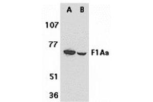 Western Blotting (WB) image for anti-Fem-1 Homolog B (FEM1B) (C-Term) antibody (ABIN1030384)