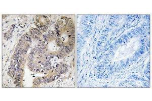 Immunohistochemistry (IHC) image for anti-Carbamoyl-Phosphate Synthetase 2, Aspartate Transcarbamylase, and Dihydroorotase (CAD) (pThr456) antibody (ABIN1847749) (CAD antibody  (pThr456))