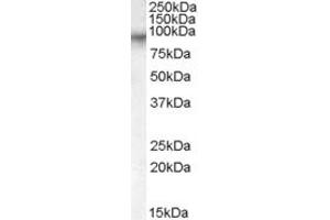 Western Blotting (WB) image for anti-Coagulation Factor XIII, A1 Polypeptide (F13A1) (AA 703-717) antibody (ABIN291434) (F13A1 antibody  (AA 703-717))