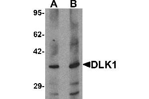 Western blot analysis of HepG2 in 293 cell lysate with DLK1 antibody at (A) 1 and (B) 2 µg/mL. (DLK1 antibody  (C-Term))