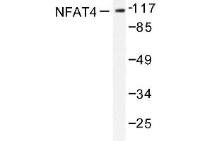 Image no. 1 for anti-Nuclear Factor of Activated T-Cells, Cytoplasmic, Calcineurin-Dependent 3 (NFATC3) antibody (ABIN272044) (NFATC3 antibody)