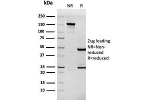 SDS-PAGE Analysis Purified Tenascin C Mouse Recombinant Monoclonal Antibody (TNC/3635). (Recombinant TNC antibody)