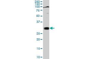 TGIF2 monoclonal antibody (M02), clone 5B11. (TGIF2 antibody  (AA 131-236))
