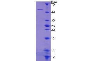 Image no. 1 for Cytohesin 1 (CYTH1) (AA 1-398) protein (His tag) (ABIN6237972)