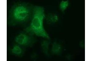 Immunofluorescence (IF) image for anti-Aldehyde Dehydrogenase 1 Family, Member L1 (ALDH1L1) antibody (ABIN1496582) (ALDH1L1 antibody)
