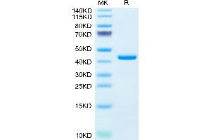 Resistin Protein (RETN) (AA 17-108) (Fc Tag)