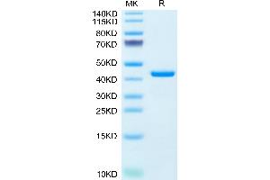 Human RETN on Tris-Bis PAGE under reduced condition. (Resistin Protein (RETN) (AA 17-108) (Fc Tag))