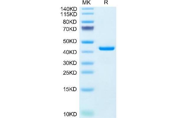 Resistin Protein (RETN) (AA 17-108) (Fc Tag)