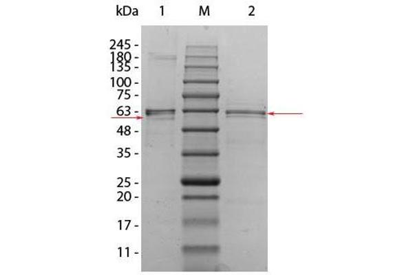 AKT2 Protein