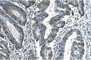 IHC analysis of SLBP using anti-SLBP antibody (ABIN7600074).