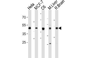 MEK2 (P2K2) Antibody (N-term) (ABIN1882178 and ABIN2842061) western blot analysis in Hela,MCF-7,rat C6 cell line and mouse Liver,rat Brain tissue lysates (35 μg/lane). (MEK2 antibody  (N-Term))