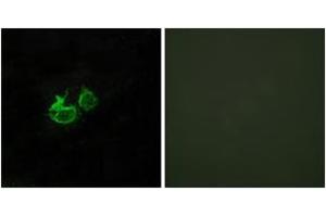 Immunofluorescence analysis of HuvEc cells, using GHRHR Antibody. (GHRHR antibody  (AA 351-400))